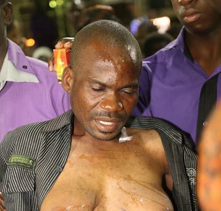 Strange! Man who Developed Scary Huge Breasts Dumped by Wife (Photos)