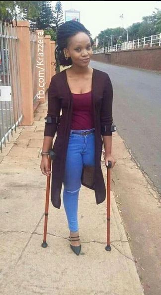 Heartbreaking: Picture of a Beautiful Damsel with Just 'One Leg
