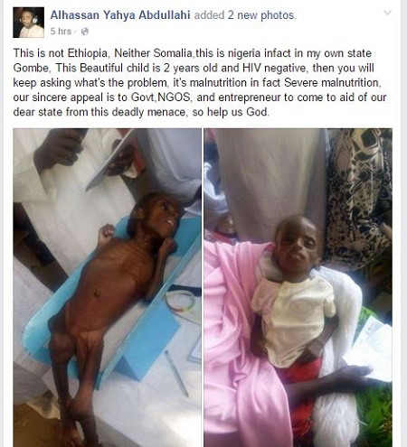 See Photos of a Starving and Malnourished 2-year-old Child From Gombe State 9