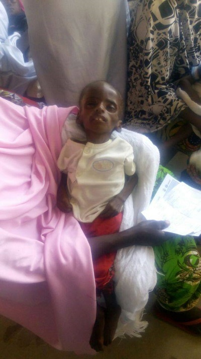 See Photos of a Starving and Malnourished 2-year-old Child From Gombe State 8