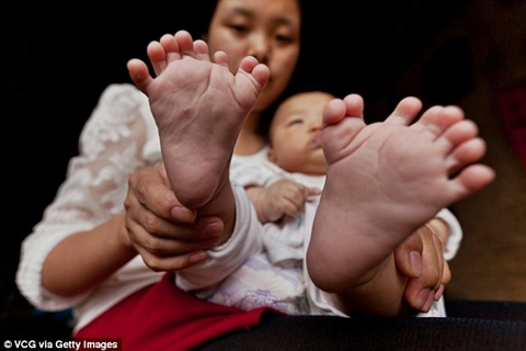 Meet the Baby Boy Who was Born with 15 Fingers and 16 Toes ...