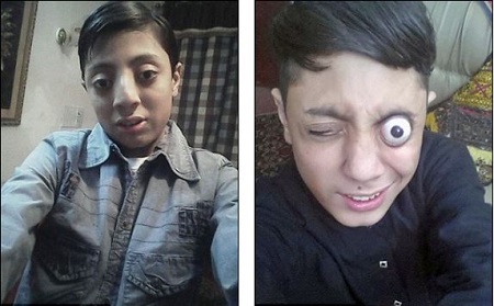 WTF? Meet Teenager Who Can Literally Pop His Eyes Out Of His (VIDEO) - Gistmania