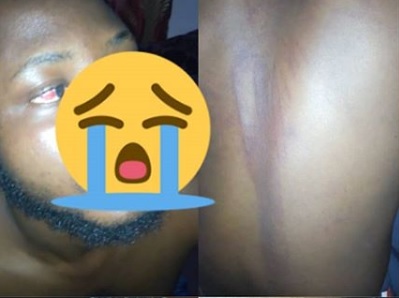 Nigerian Singer, Dollarboi Shares Photos If His Battered Body As He Recounts Ordeal With SARS %Post Title