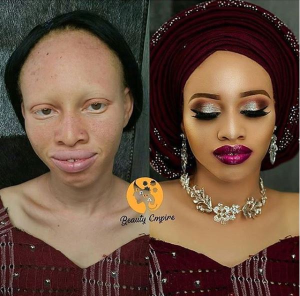Ære Børnepalads sang Amazing Makeup Transformation Of An Albino Lady (Photos) - Fashion - Nigeria