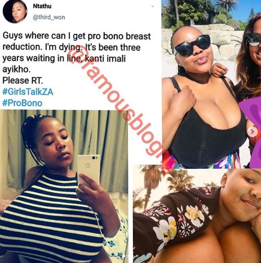 Read The Shocking Story Of Lady Struggling To Live With Her Heavy Breasts  (Photos)