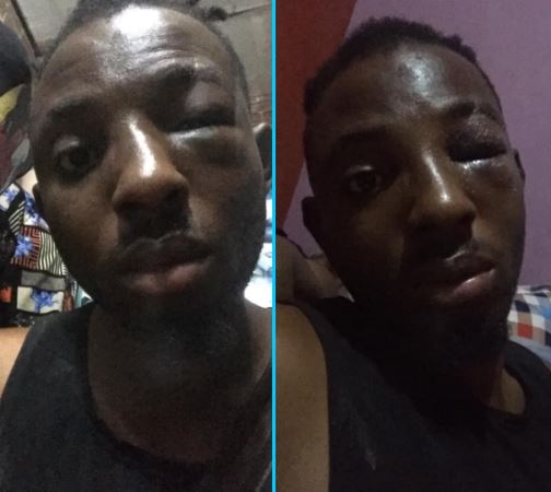 Man beaten by thugs his girlfriend hired
