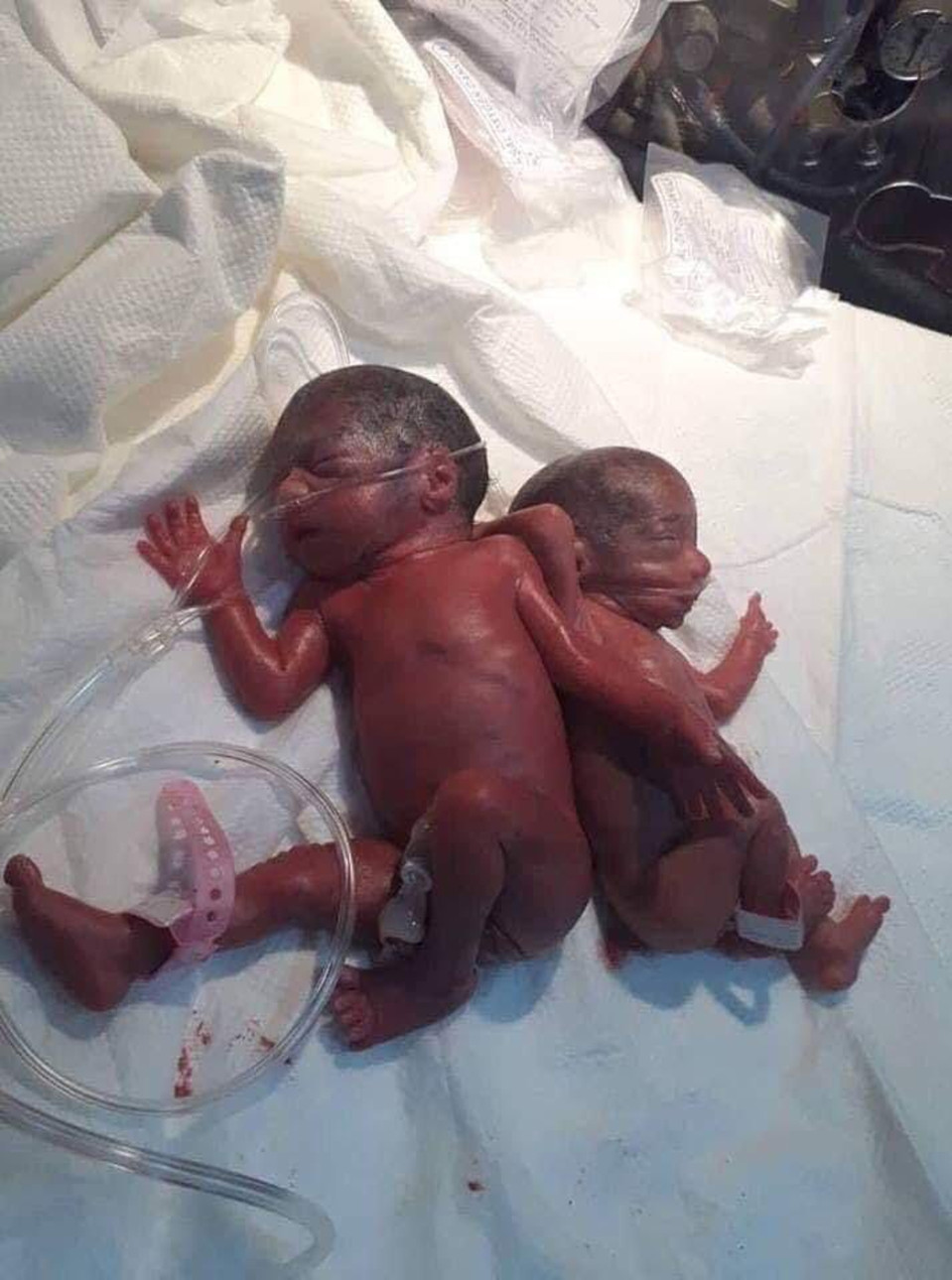 25-Year-Old New Mum Gives Birth 7 Healthy Babies In Single Birth