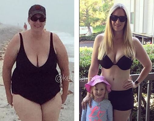 34-year-old Woman On Ketogenic Diet Shares Shocking Weight Transformation Photos 