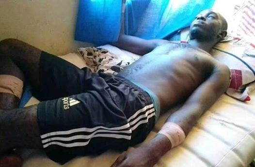 Man macheted by elder brother