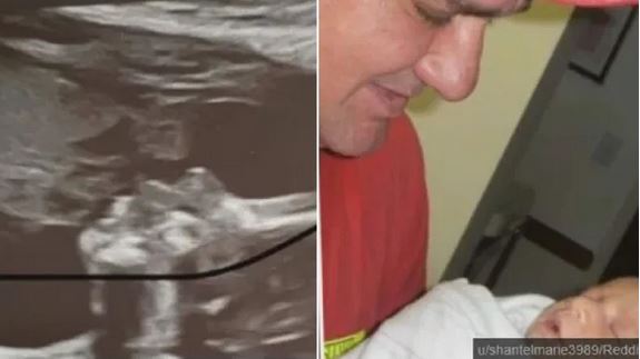 Shantel Carrillo ultrasound