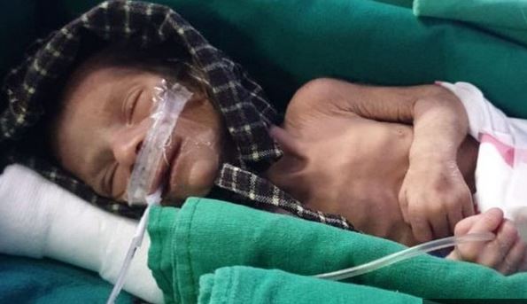 The newborn is recovering in hospital 