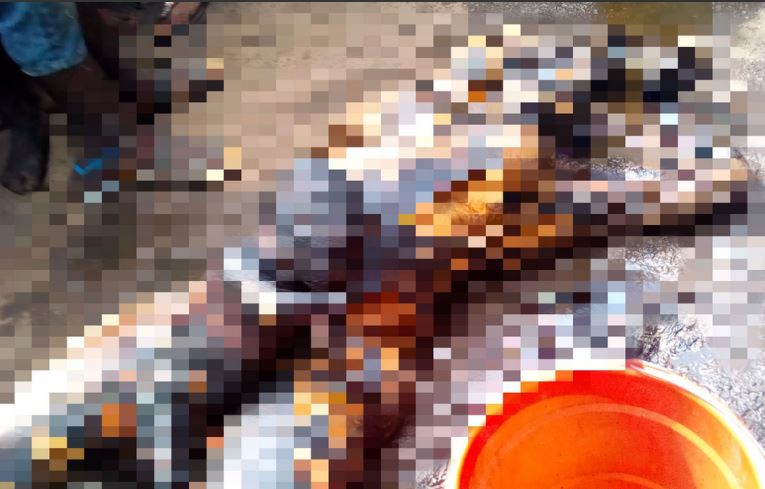 mother and child burnt