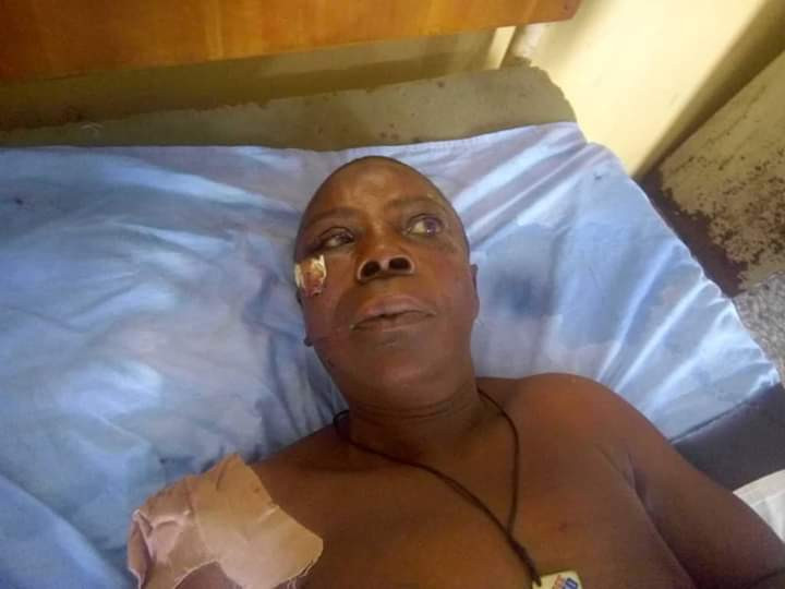 Unidentified woman in hospital after being hit by a driver