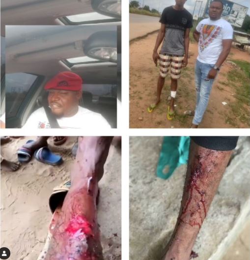 Boy attacked by SARS