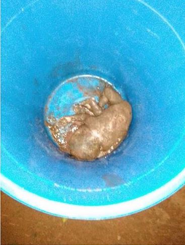 foetus