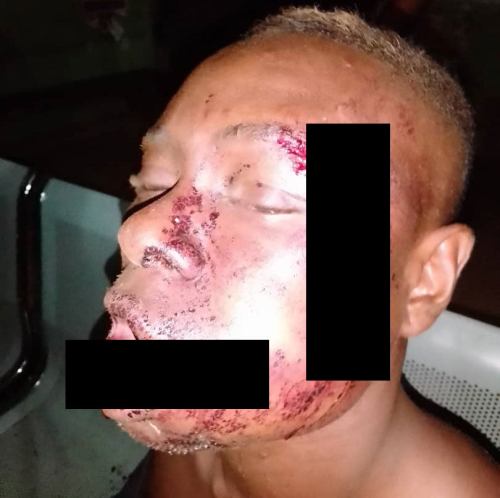 The OPC member attacked by Fulani Herdsmen