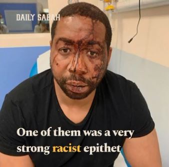 The victim battered by the police