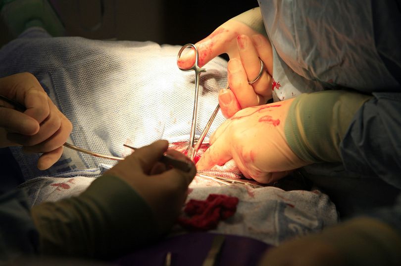 Organ harvesters