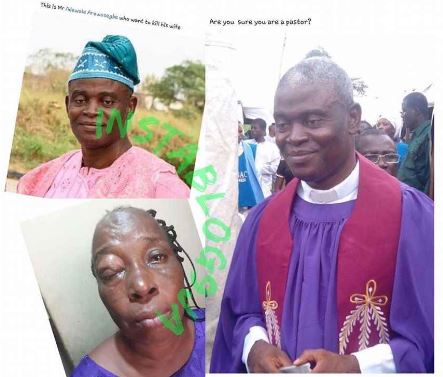 The man of God attacked his wife leaving her almost blind