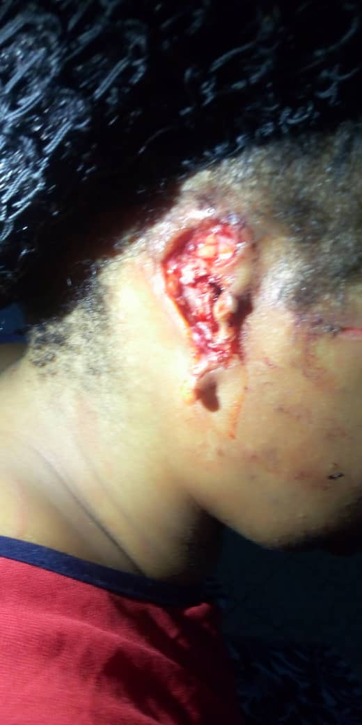 Unbelievable! Husband Bites Off His Wife's Ear In Niger State (Graphic Photos)