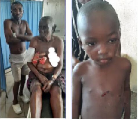 Benue survivors
