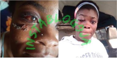 Amaka left seriously injured for visiting her lover in Lagos