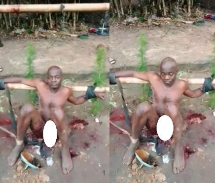 Man's penis mutilated by IPOB supporters