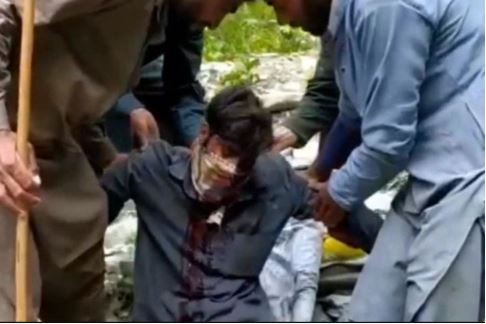 Man attacked by a bear