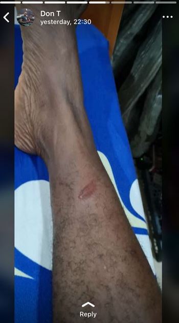 leg