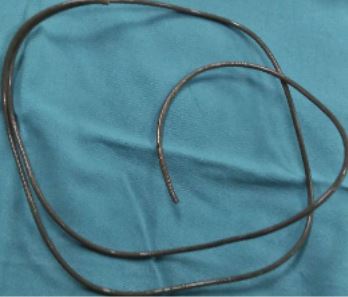 Wire