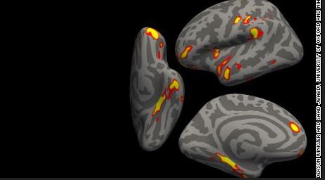 brain