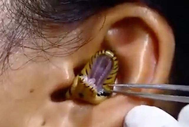 ear