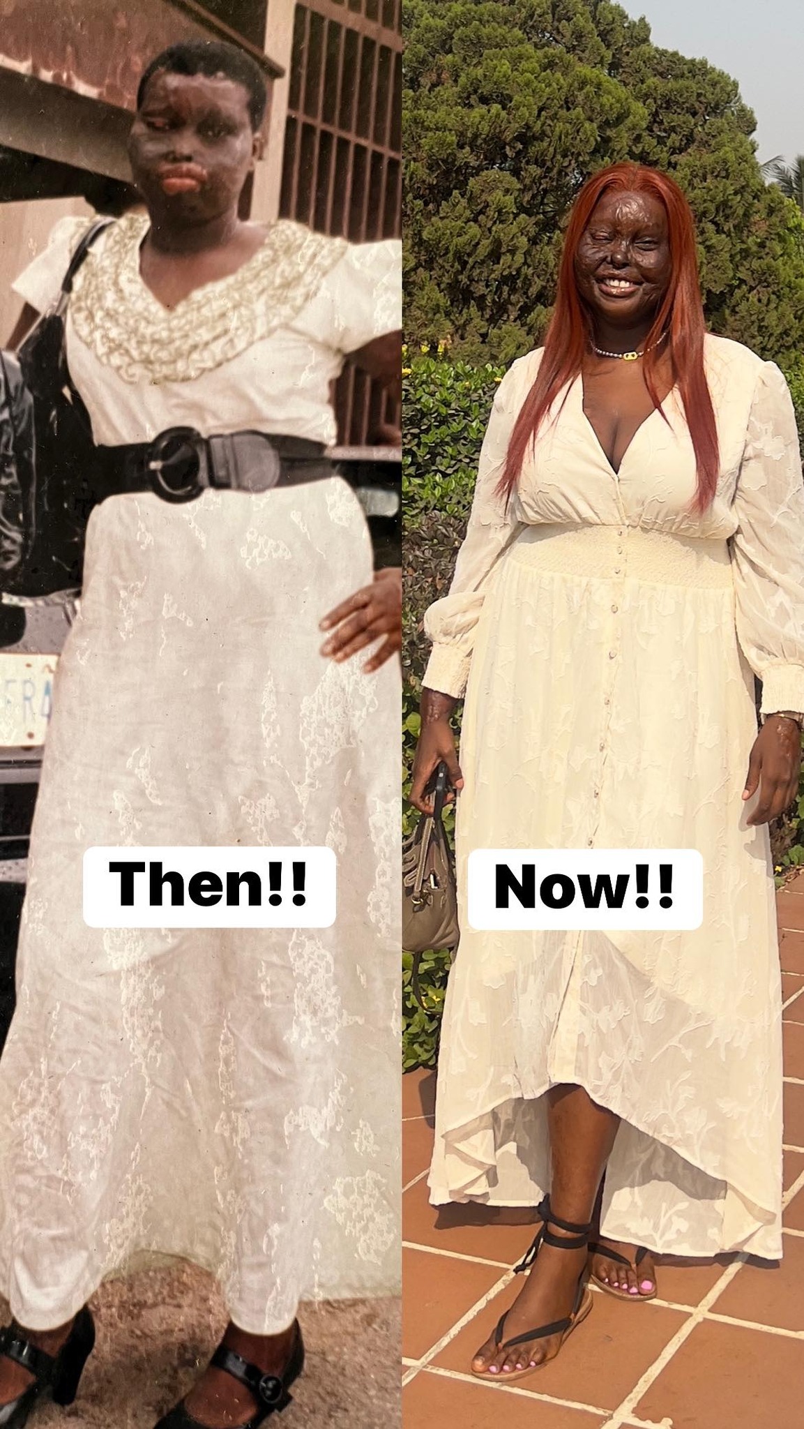 Chizoba Francess Obanye