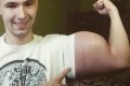 Trouble: This Man May Soon Have His Hands Cut Off After Injecting His Arms With Oil To Look Big 