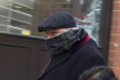 Shocker: How Popular Surgeon Marked His Own Initials On The Liver of a Sick Woman During Operation 