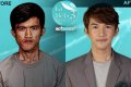 Woman Fails To Recognize Her Own Son After Plastic Surgery Drastically Alters His Appearance (Photos)