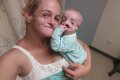 Unbelievable: See the 8-month-old Baby Who Needs Surgery Every Six Months Until She