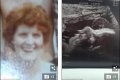 Pregnant Woman In Shock After Seeing The Face Of Her 