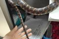The Moment A Brave Woman Walks Into A Hospital Holding The Snake That Bit Her (Photos)