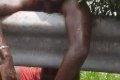 Nigerian Man Jumps From Upstairs To Avoid Malaysian Police, Gets Badly Injured (Graphic Photos)