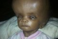Too Bizarre! Baby Girl in Severe Pain as Head Continues to Swell in Jigawa State (Disturbing Photos)