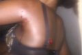 See Graphic Photo Of 8-months Pregnant Woman Shot By Custom Officers in Ogun State