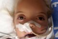 Shocker: Snake Crawls Into Little Girl