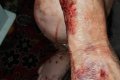 Shock As Elderly Man Gets Mauled By Unknown Animal While Sleeping At Night (Graphic Photos) 
