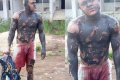Man Gets Badly Burnt While Allegedly Trying To Steal From A Transformer (Graphic Photos/Video)