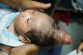 So Weird: Meet The Little Baby Boy Who Was Born With A 