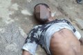 Tragedy As Young Man Drinks Poison After Allegedly Catching His Girlfriend Cheating On Him (Photos) 