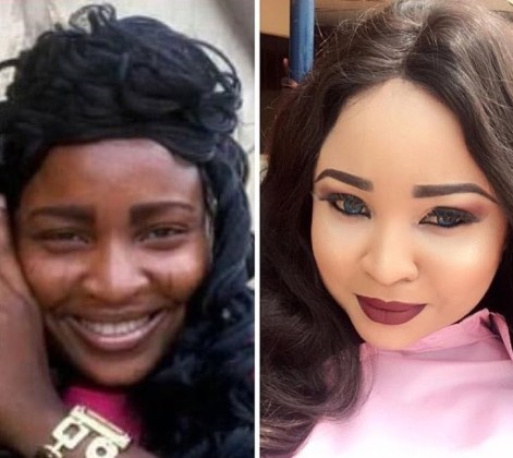 Unbelievable Transformation: Alleged Before And After Bleaching Photos