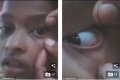 Shocking: This Young Girl Has Ants Living Inside Her Eyes And No One Knows How They Got There (Photos)