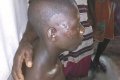 15-year-old Girl Cuts Open A Boy